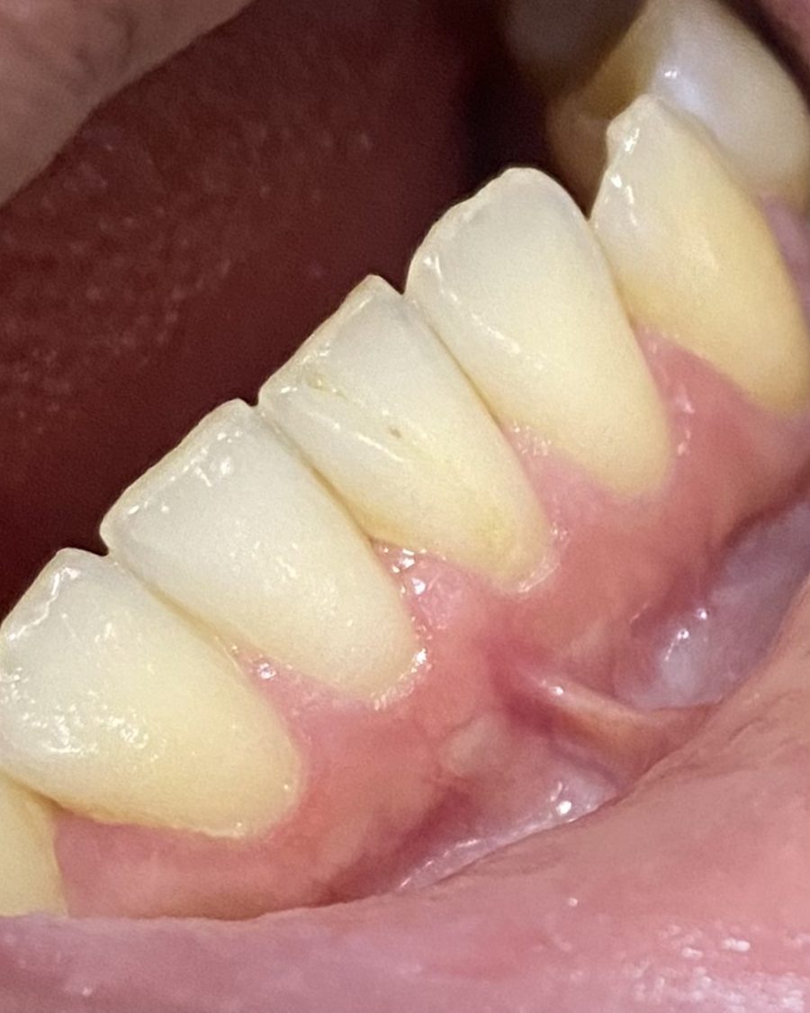 Encía sana y dientes limpios en primer plano